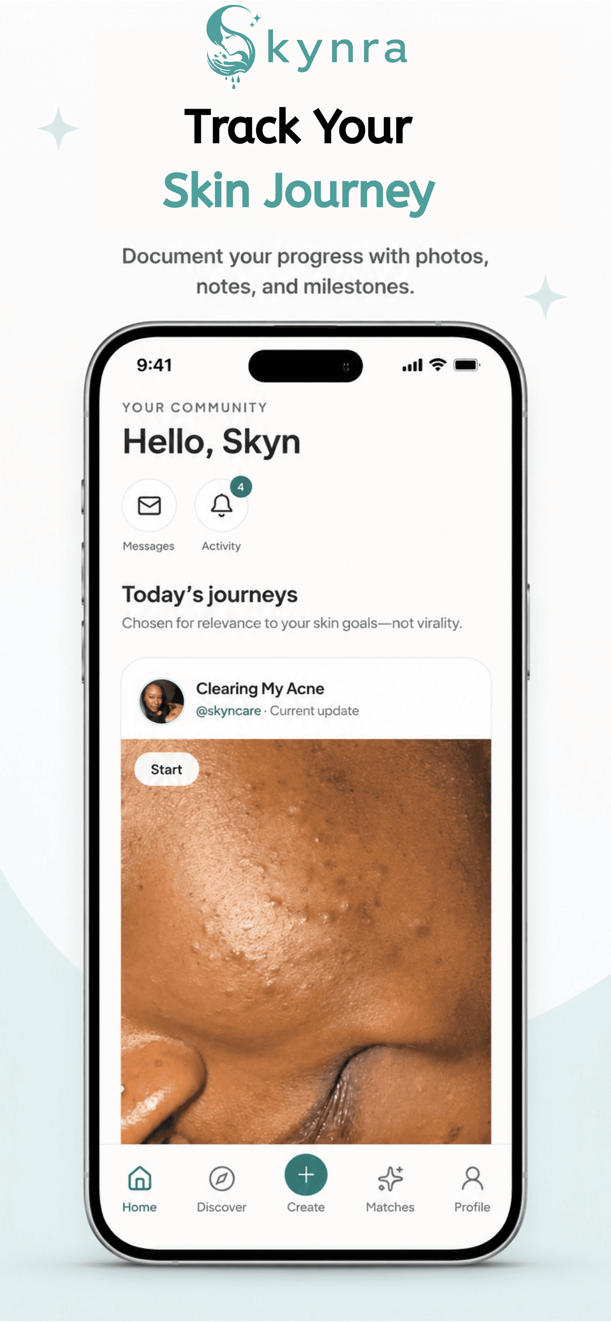 Skynra beta preview showing the Track Your Skin Journey experience