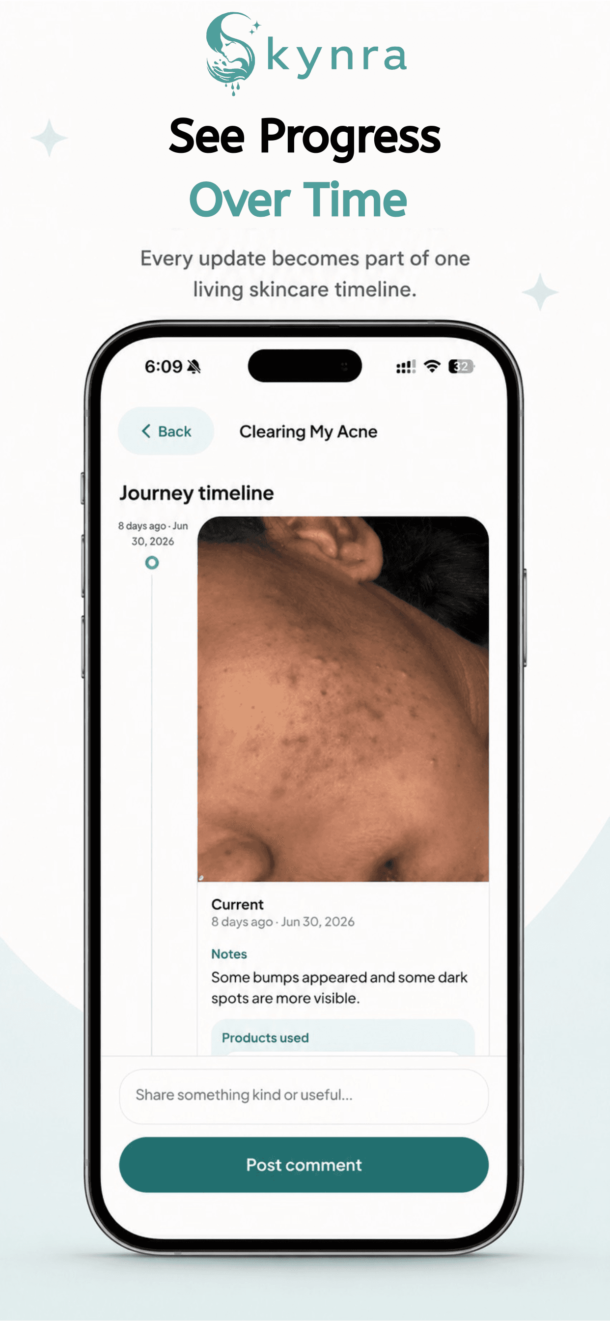 Skynra beta preview showing the Discover screen